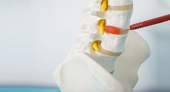 herniated disc knightdale nc camelot chiropractic centre raliegh nc wendell nc zebulon nc garner nc wake forest nc